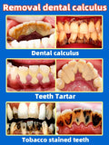 Toothpaste Whitening Tooth Remove  Stains