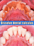 Toothpaste Whitening Tooth Remove  Stains